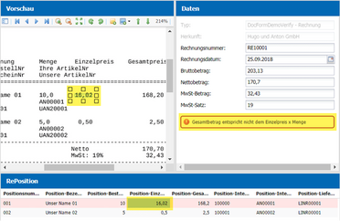 Bild zeigt einen Fehler bei der Abgleichung der Rechnungspositionen im Dokumentenmanagement-System, wo der Gesamtbetrag nicht mit Einzelpreis x Menge übereinstimmt.